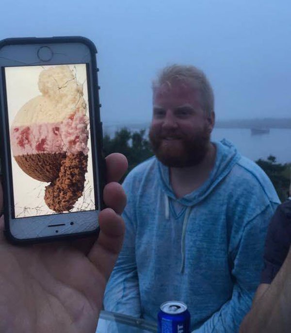 Man who looks like neopolitan ice cream with his blonde hair, pink burnt skin and brown beard
