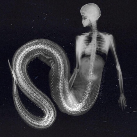 x-ray of human mermaid hybrid