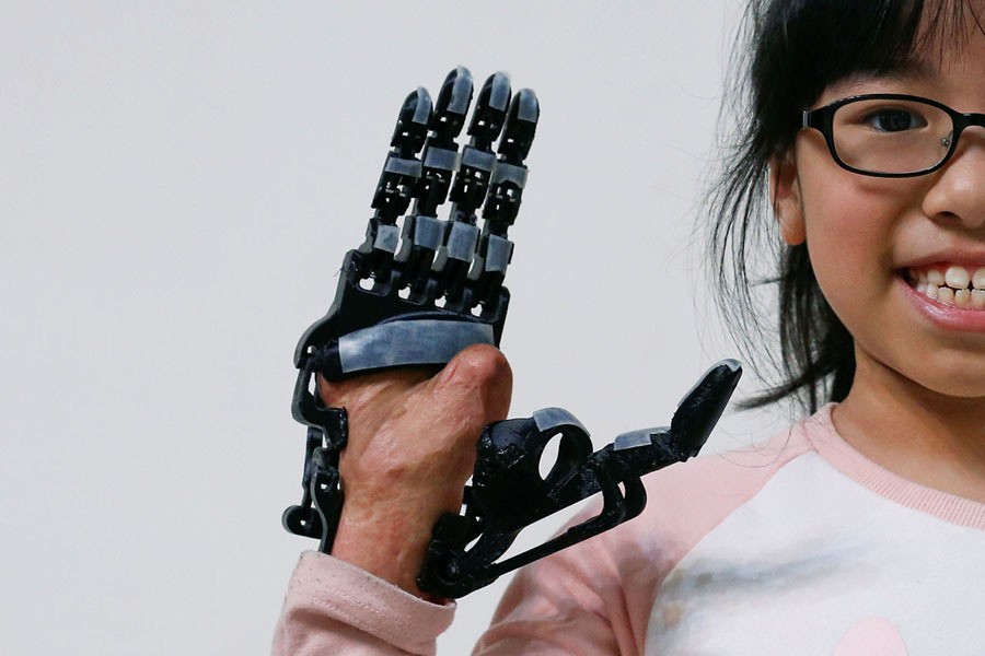 Angel Peng, 8, who injured her hand in a scalding accident when she was nine months old, poses for a photograph wearing a 3D-printed prosthetic hand designed and built by engineer Chang Hsien-Liang, in Taoyuan, Taiwan, on April 6, 2017. After losing his own right forearm in a factory accident, Chang tried several artificial limbs but he was never satisfied. The arms he could afford were too basic and the robotic hand he wanted was too expensive. So the 46-year-old engineer set out to design and build his own prosthetic arm using 3D printing technology. Now, Chang wants to help others, and is designing and building a prosthetic hand for Angel Peng.