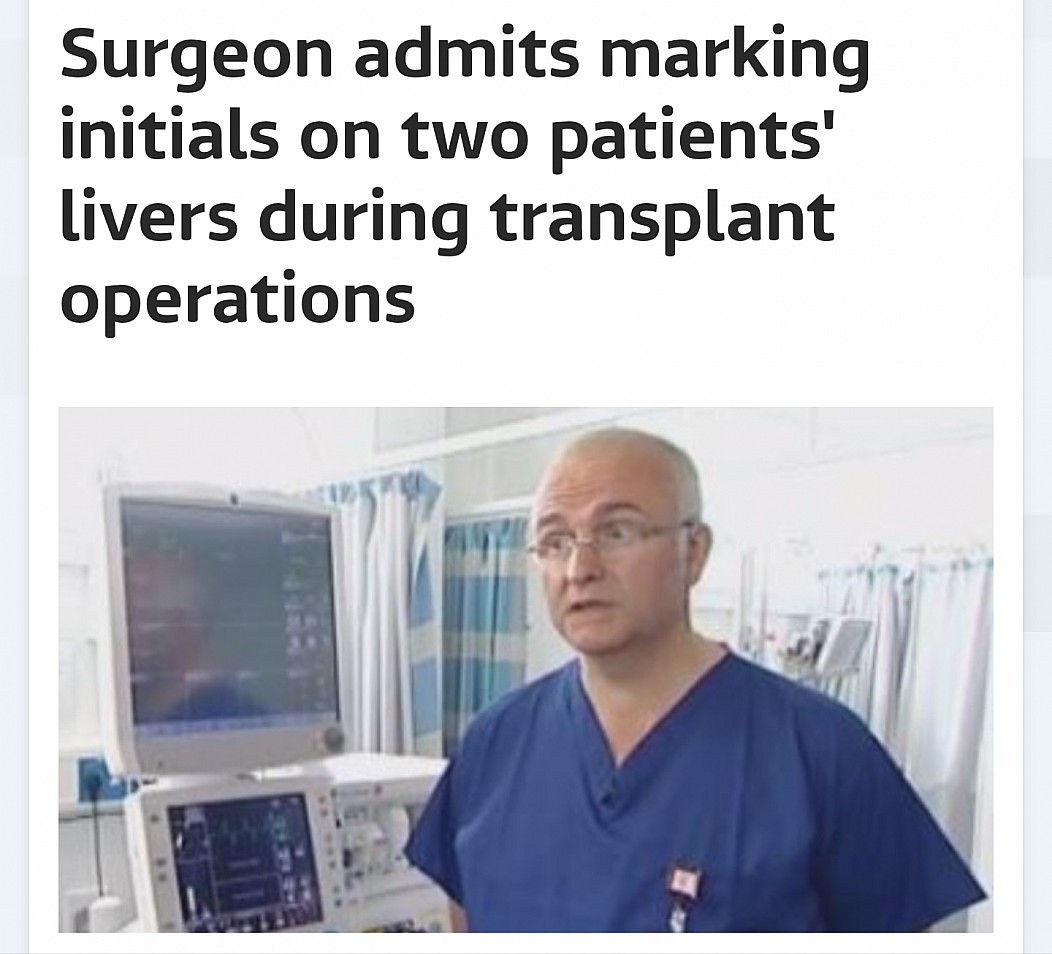 remarkable image of doctor surgeon admits marking initials on two patients' livers during transplant operations