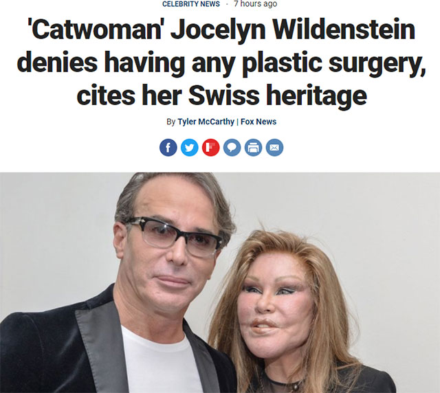 jocelyn wildenstein before - Celebrity News 7 hours ago 'Catwoman' Jocelyn Wildenstein denies having any plastic surgery, cites her Swiss heritage By Tyler McCarthy | Fox News