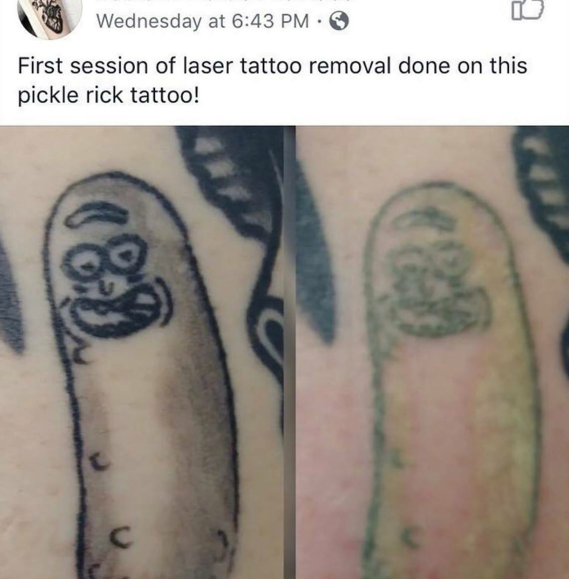 amazing picture of pickle rick tattoo removal - Wednesday at First session of laser tattoo removal done on this pickle rick tattoo!
