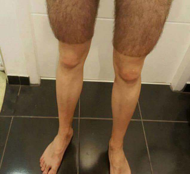 do you shave above the knee