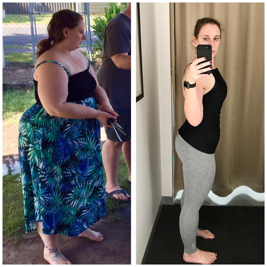 The typical before and after weight loss photo. Shedding a whopping 150 pounds! What did she do with the extra skin hanging around? 