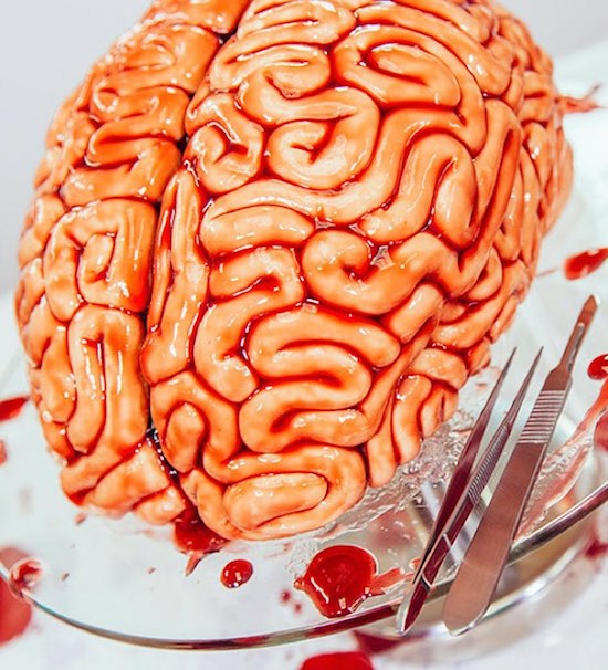 bloody brain and scalpal for disection