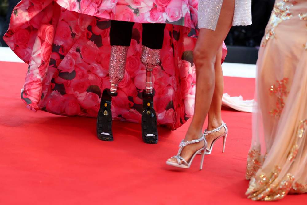 formal wear prosthetic legs
