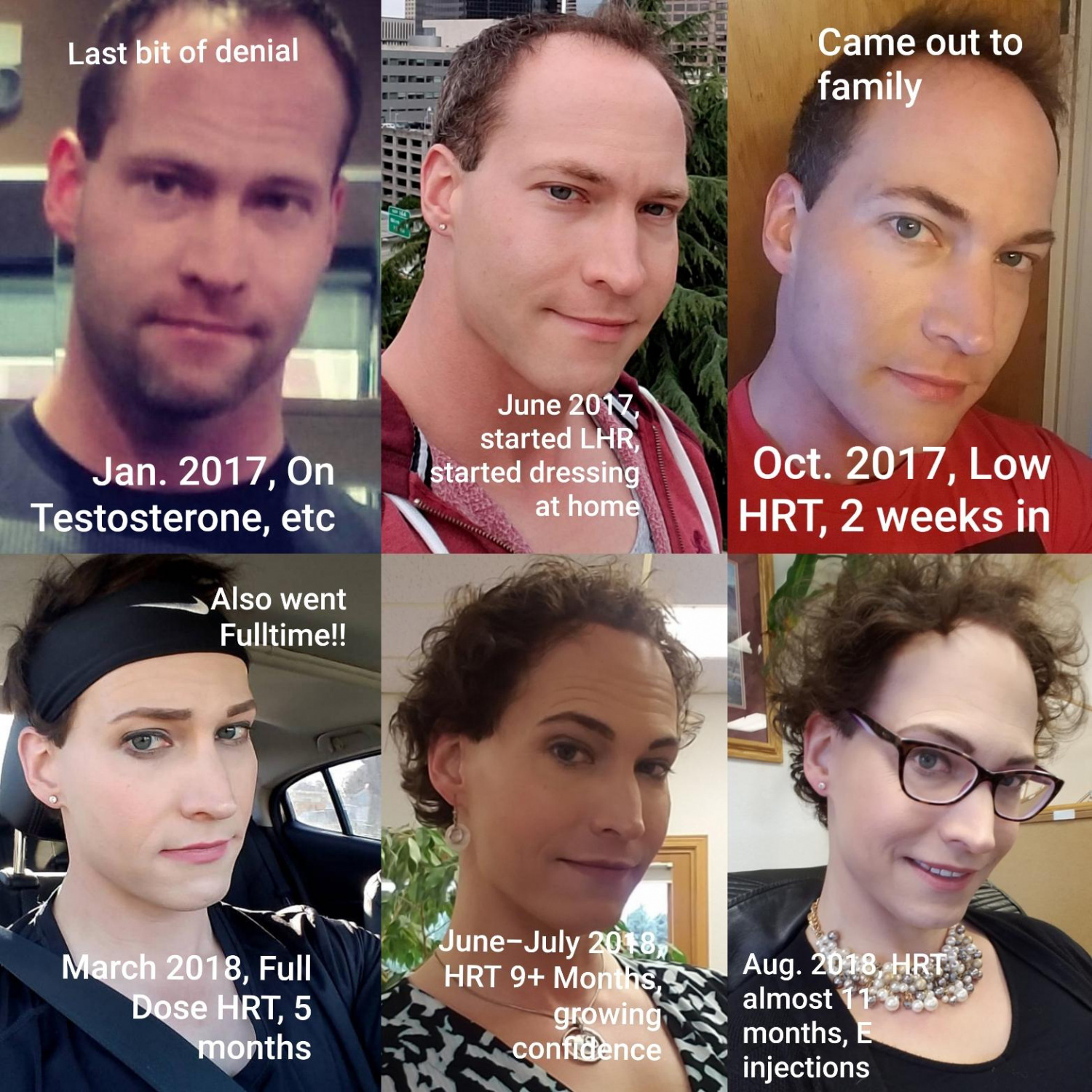 hair coloring - Last bit of denial Came out to family Jan. 2017, On Testosterone, etc June 20N started Lhr started dressing at home Oct. 2017, Low Hrt, 2 weeks in Also went Fulltime!! June, Hrt 9 Moms Aug. 2018, Hrte , Full Dose Hrt, 5 months growing almo