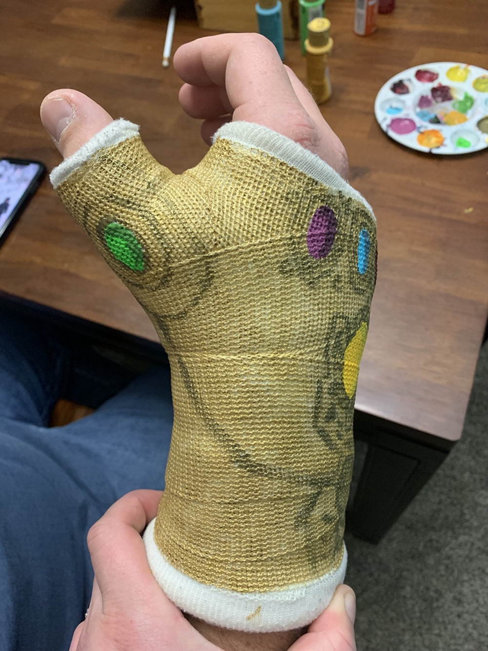 thanos wrist cast