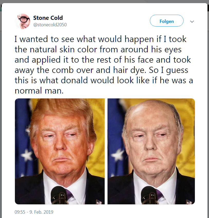 trump without hair - Stone Cold Folgen I wanted to see what would happen if I took the natural skin color from around his eyes and applied it to the rest of his face and took away the comb over and hair dye. So I guess this is what donald would look if he