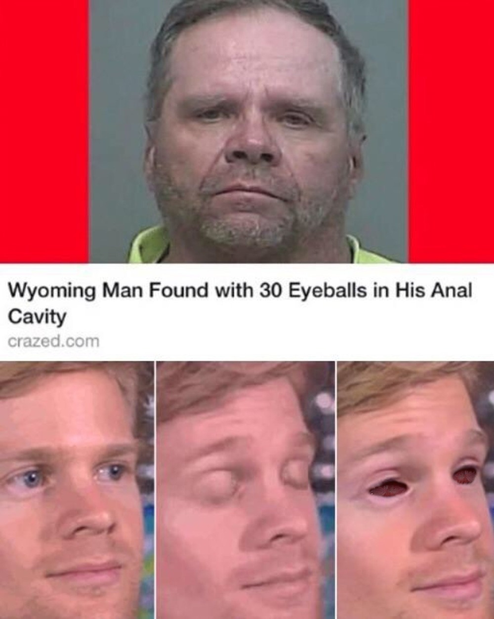 wyoming man found with 30 eyeballs in his anal cavity - Wyoming Man Found with 30 Eyeballs in His Anal Cavity crazed.com