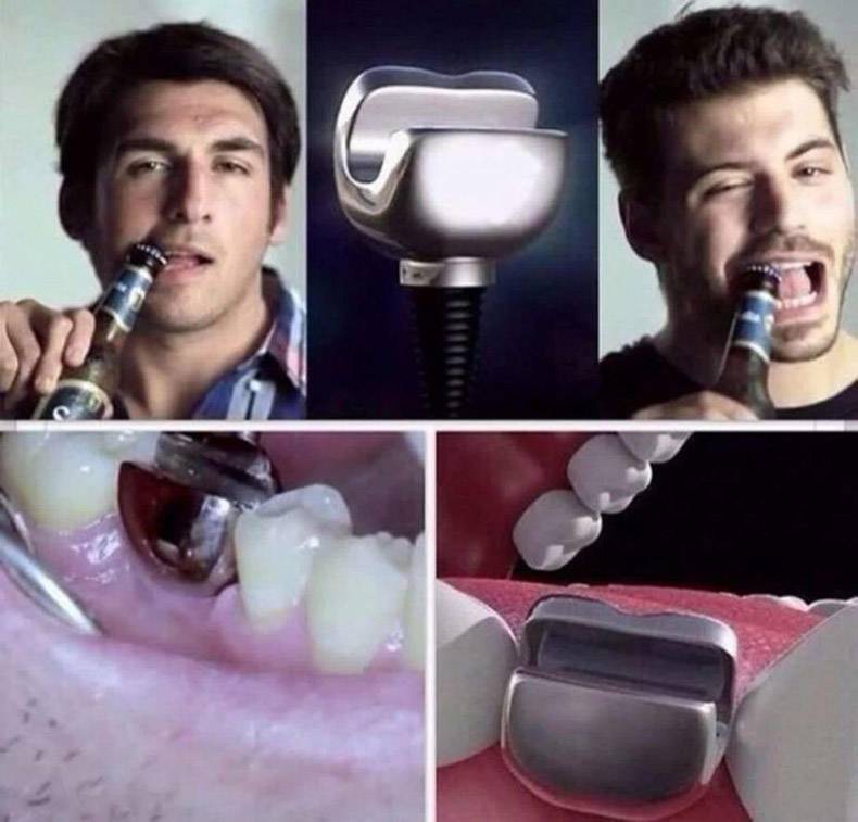 bottle opener tooth implant