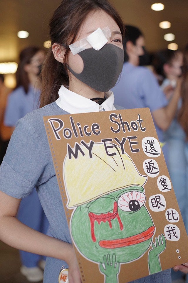 random pepe hong kong - Police Shot My Eye E