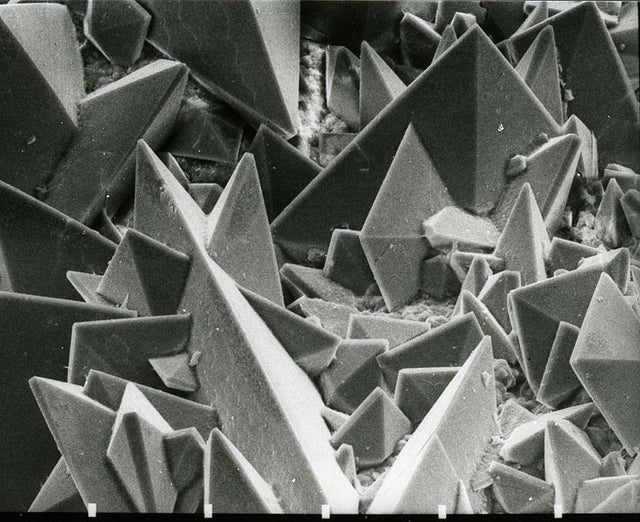 Surface of a kidney stone under an electron microscope.
