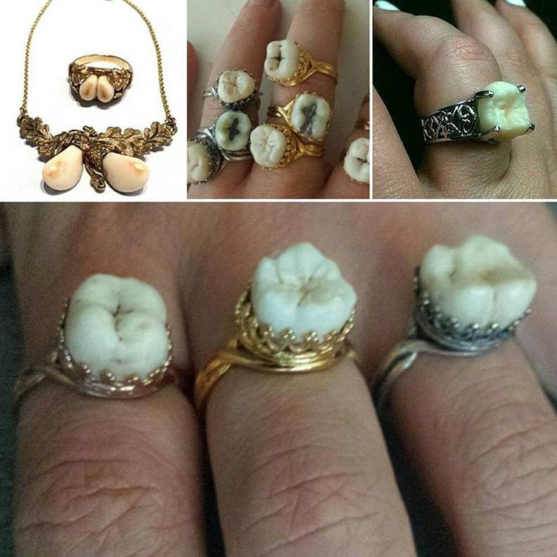 funny pics and memes - tooth ring