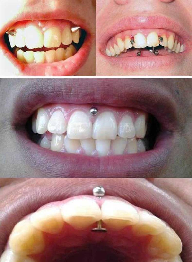 funny rando pics - mouth piercings