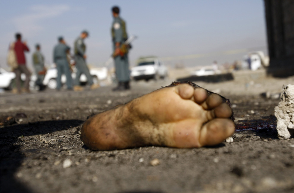A suicide bomber's foot is seen at the site of a blast in Kabul, Afghanistan on July 22, 2008. The bomber killed three civilians and wounded one more in the attack, a police official said. (REUTERS/Ahmad Masood) #
