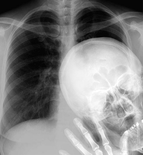 Another x-ray gag. amusing