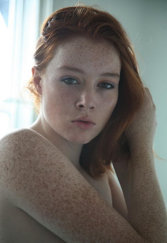 Fine Freckled Females
