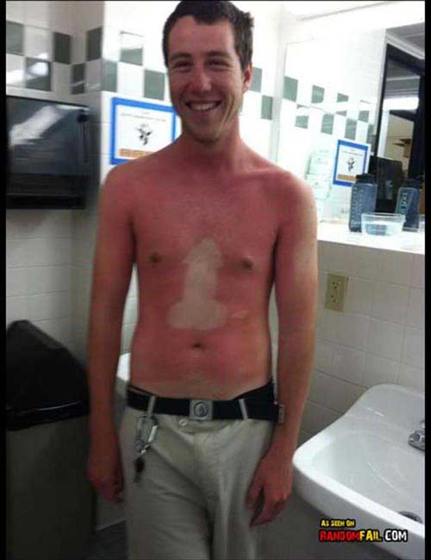 Funny sunburns