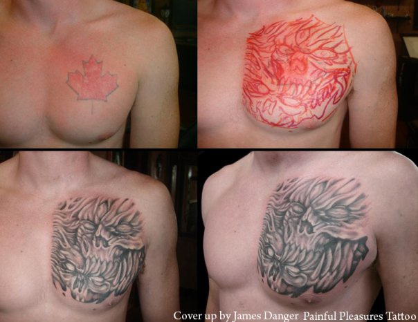 People saved from their horrible tattoos
