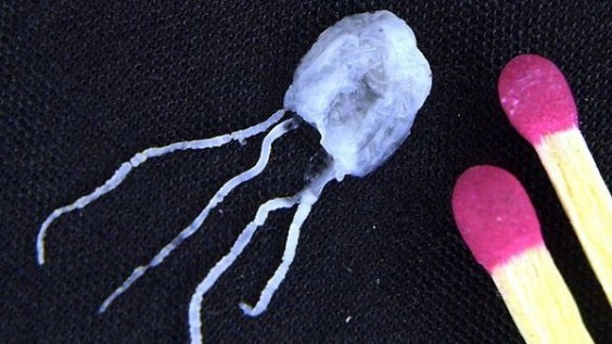 Irujkandji Jellyfish - Irukandji Jellyfish are remarkably toxic, and give the victim what is known as Irukandji syndrome, which can lead to cardiac arrest if not treated within the first 20 minutes.