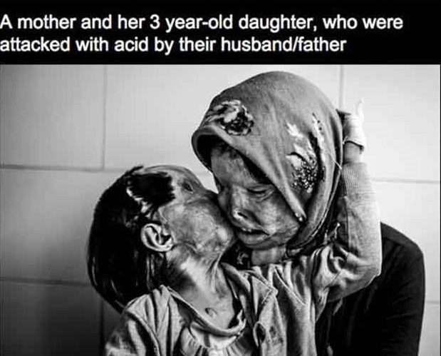 health and safety at work - A mother and her 3 yearold daughter, who were attacked with acid by their husbandfather