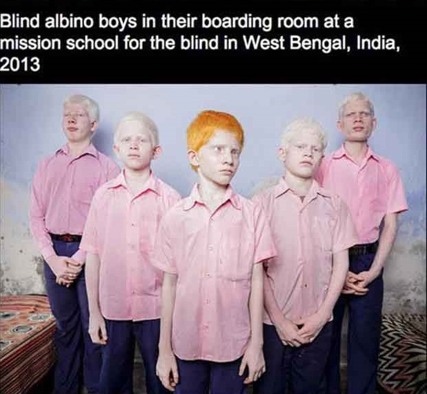 blind indian albino boys - Blind albino boys in their boarding room at a mission school for the blind in West Bengal, India, 2013