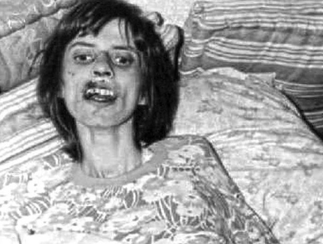 In 1968, when she was 16 years old, Anneliese Michel began suffering from regular convulsions. Doctors diagnosed her with a strong psychosis. According to old medical reports, she would hallucinate demonic faces throughout the day and hear voices that told her she was "damned." Those same reports also describe episodes where Michel would make demonic faces, rip her clothes, eat coal, and lick up her own urine. After her family exhausted their patience with traditional medicine, they called in a priest to perform an exorcism. In total, Michel underwent 76 exorcisms before dying of starvation when she refused to eat.
