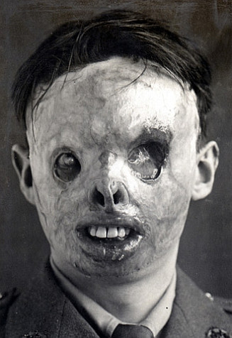 The masks were hideous to look at, but they were, at times, far more appealing then the badly maimed faces underneath.