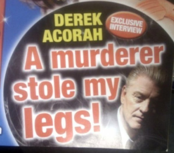Derek Exclusive Acorah Interview A murderer stole my legs!