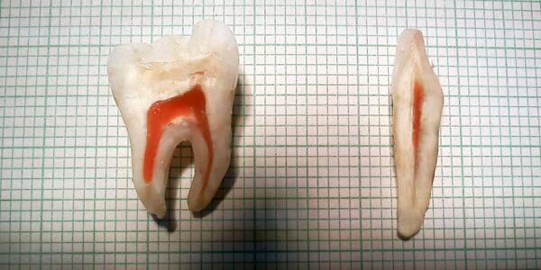 tooth cut in half