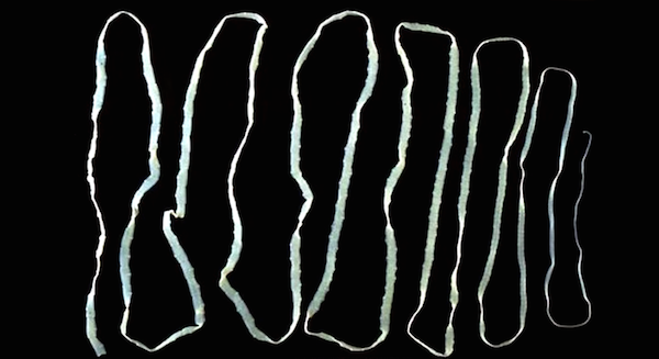 Tape worms can live in human intestines for up to 25 years. The largest ever found was 82 feet long.