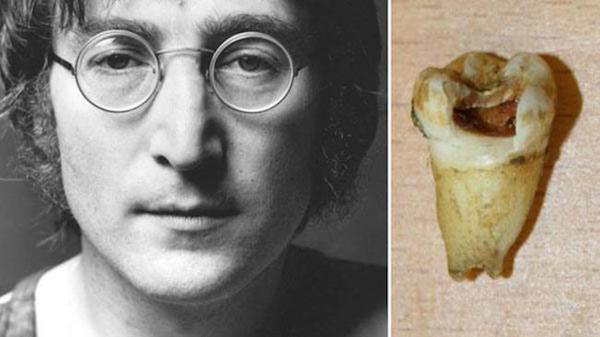 John Lennon’s Tooth – $31,000