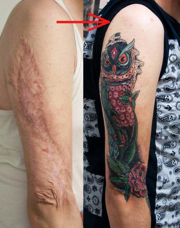 scar tattoo cover up