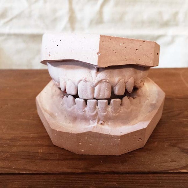 At only $25, you can own these nightmarish plaster teeth.