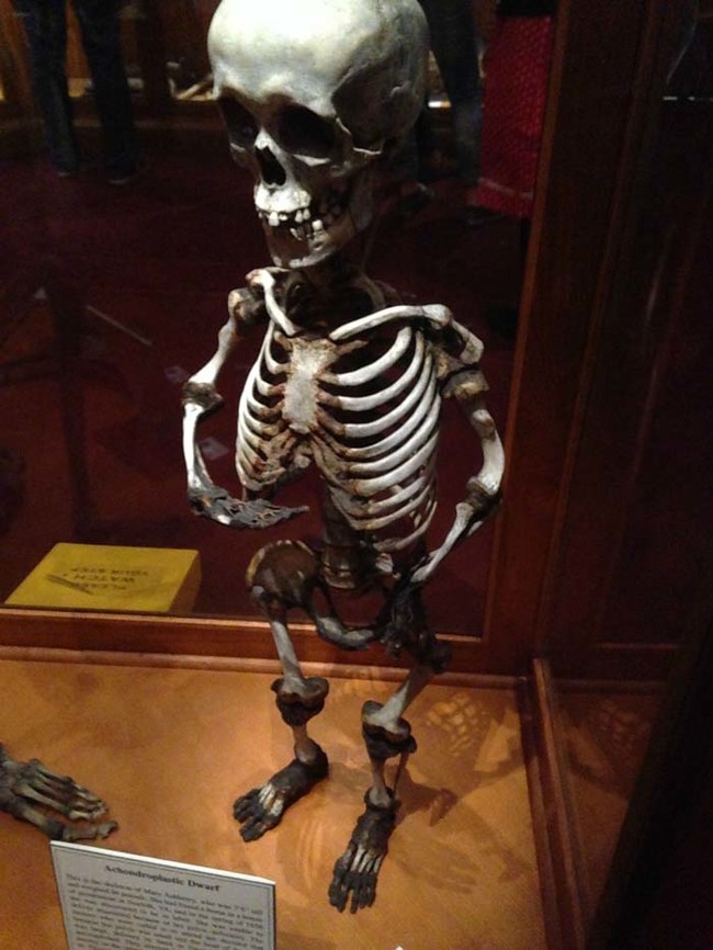 The skeleton of a dwarf.