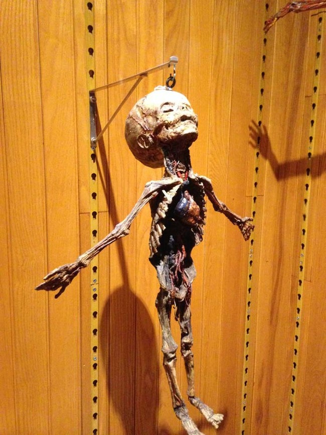 Wax model of a child's body.