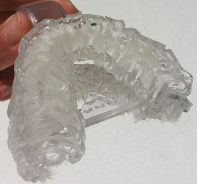 This custom mouthguard thing brushes your teeth in one minute flat.