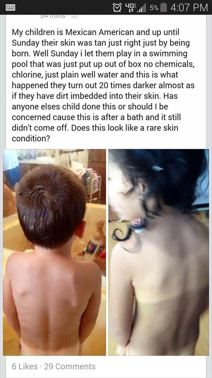 too dumb - 45.5% 34 Ts My children is Mexican American and up until Sunday their skin was tan just right just by being born. Well Sunday i let them play in a swimming pool that was just put up out of box no chemicals, chlorine, just plain well water and t