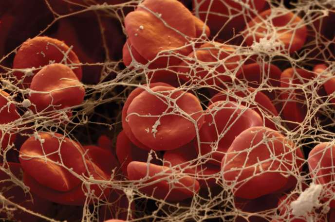 Scabbing blood : When red blood cells begin to scab, a substance that looks like spider webs grow over them.