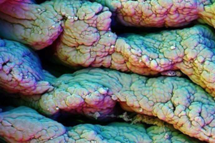 Small intestine : The small intestine looks like a pile of used chewing gum stuck together