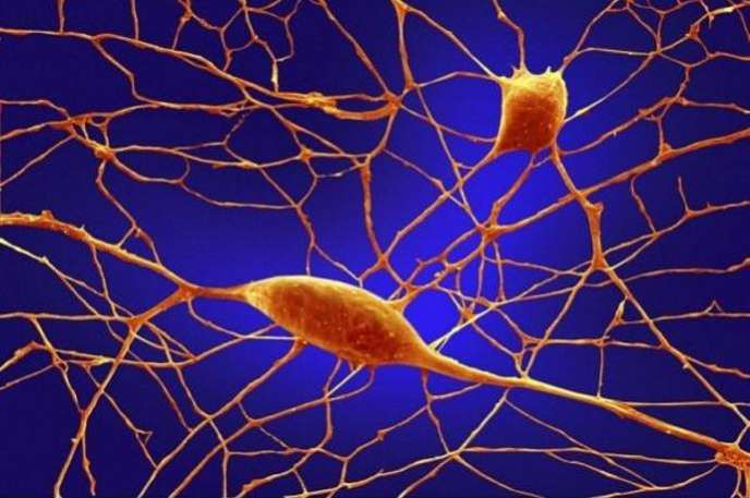 Brain Neurons : No this isn’t a breeding ground for the offspring of the Honey Monster, it’s brain neurons