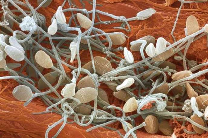 Sperm : They may look like tiny mushrooms, but these little guys are pretty important!