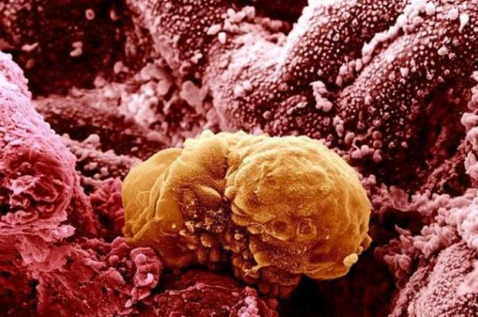 Human Embryo : This is an embryo that is only six days old and getting ready to implant into the uterus