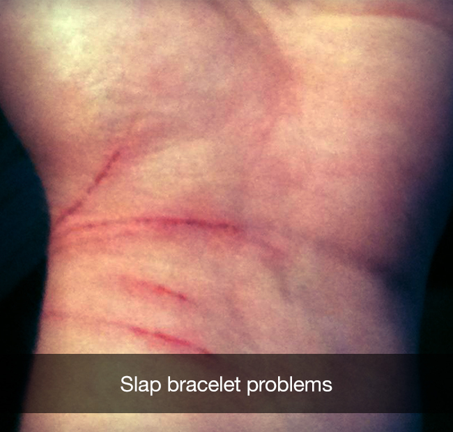 close up - Slap bracelet problems