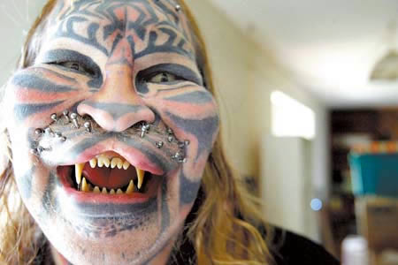 Dennis Avner: Catman: Dennis Avner, also known by "Catman" or his native american name of "Stalking Cat", undergone incredible extensive surgery in order to look like his totem animal, the tiger. Modifications include extensive tattooing, transdermal implants to allow whiskers to be worn, subdermal implants to change the shape of the face and the filing and shaping of the teeth to make them look more like a tiger's.