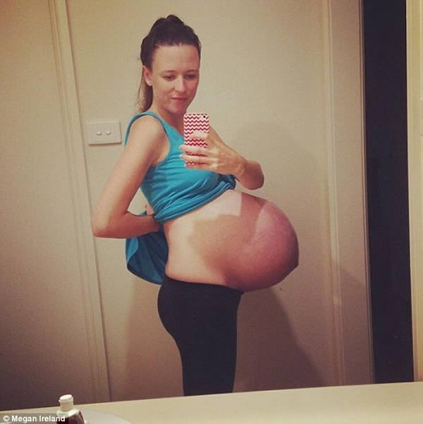 A shocked mother-of-two says she felt ill when she realized a "preggophile" Facebook creep had stolen a photograph of her with a bulging, pregnant belly. 

Megan Ireland, 24, from Sydney, was stunned to discover a mysterious vagrant was using her picture to solicit other women into posting their belly shots for a pregnancy fetish website. 

The Australian Multiple Birth Association (AMBA) sounded the alarm after discovering a woman named "Afina" was collecting images of pregnant women from mother's group pages in Australia, Canada, and New Zealand. 

After posting Ireland's picture, "Afina" (obviously a bogus profile) then invited other women to share photos of their engorged tummies. The association said the pictures were quickly uploaded to the fetish site, which features pregnant women in various states of undress. 

Ireland said she had no idea what was happening until a friend, who remembered her distinctive belly, sent her a screenshot. "I literally had never heard of this," she said. "My stomach is clearly the one that stands out from the crowd."

She said the picture was uploaded more than 18 months ago and required a lengthy scroll through her Instagram account to find. Ireland also said she was angered that the picture was being used to lure other women.