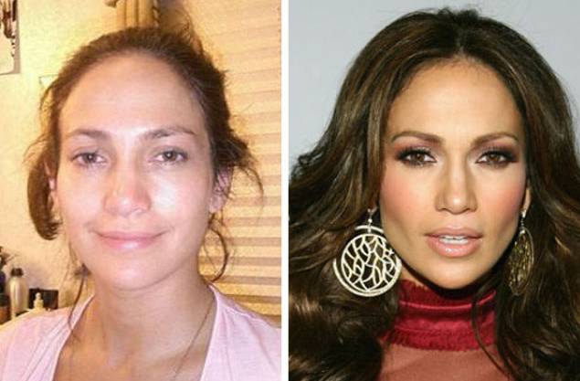 26 Celebs Before And After Their Plastic Surgery