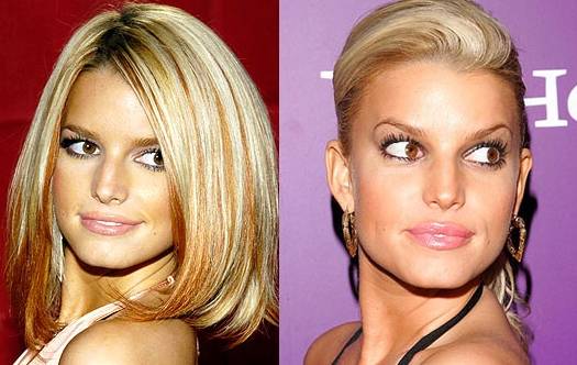 26 Celebs Before And After Their Plastic Surgery