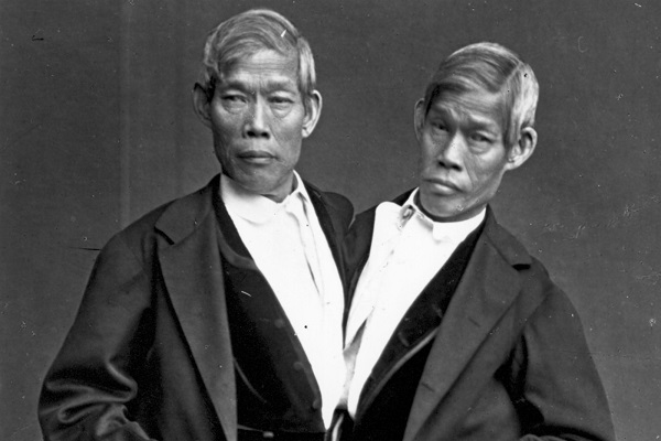 Chang & Eng were born in Siam (now Thailand). The siblings were discovered by Robert Hunter, a Scottish merchant who lived in Bangkok. He first laid eyes on the boys while they were out for a mid-day swim and was astounded by how fast they able to move in spite of their handicap. 

Hunter shelled out a significant amount of money to the brother's parents as means of adoption. Once in his care, they instantly became a part of the sideshow circuit. After their time in the spotlight, the Bunkers (Eng & Chang's adopted name) went into business for themselves and eventually settled in the town of Wilkesboro, North Carolina. They lived a good there—they fell in love, married a pair of sisters, and fathered 21 children between them. 

In their later years, things started to go south for the twins. After the Civil War, most of their hard-earned fortune had vanished, and Chang's alcoholism caused his health to suffer. Luckily, because the brothers had separate circulatory systems, Eng wouldn't have to endure the consequences of his Chang's poor choices—that is, until the morning of January 17, 1874. Eng awoke to find that his brother had died during the night as a result of a cerebral blood clot. Terrified, he immediately called for a doctor to perform an emergency separation, but it was too little too late. He died just three hours after his brother. 

While the exact cause of Eng's death remains uncertain, it's a long-standing theory that the shock of Chang's death played a role.